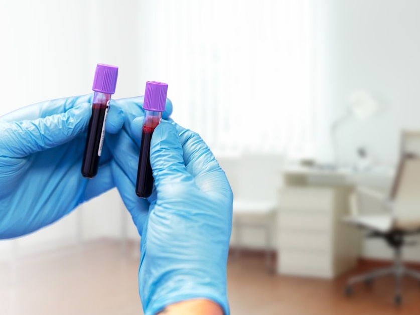 Laboratoř Valtice s.r.o. - odběrové místo v Mikulově